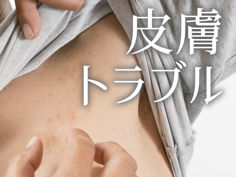 皮膚トラブル